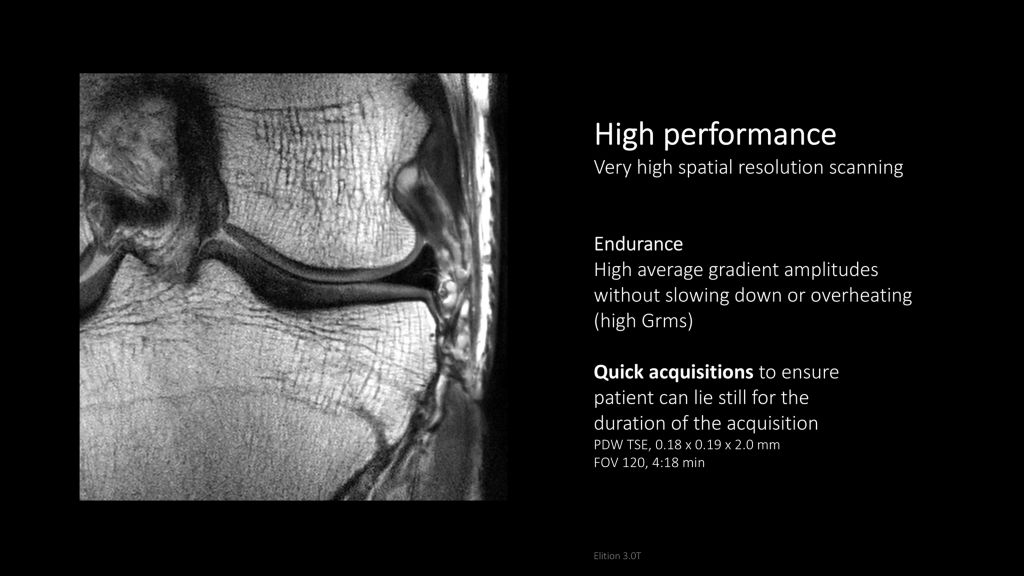 High spatial resolution scanning with Elition X
