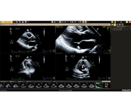 Ultrasound Workspace Image review