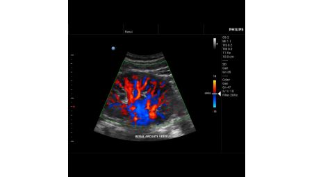 Imaging di elevata qualità