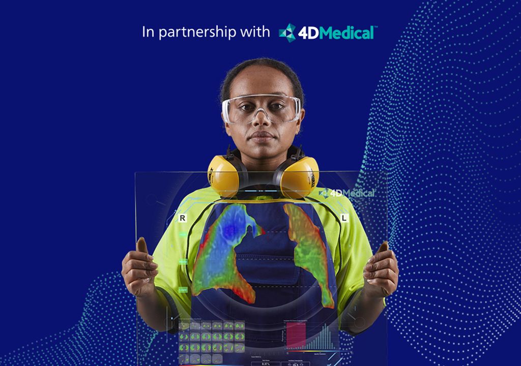 4DMedical™ XV LVAS™ Lung Ventilation Analysis Software