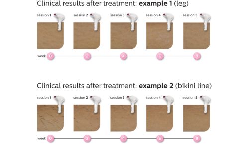 Efficacia senza sforzo