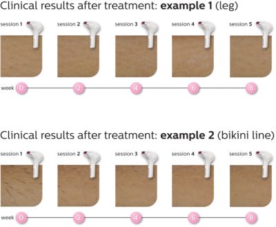 Effortlessly effective