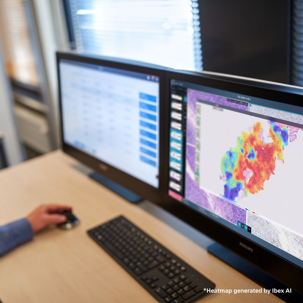 digital pathology screens
