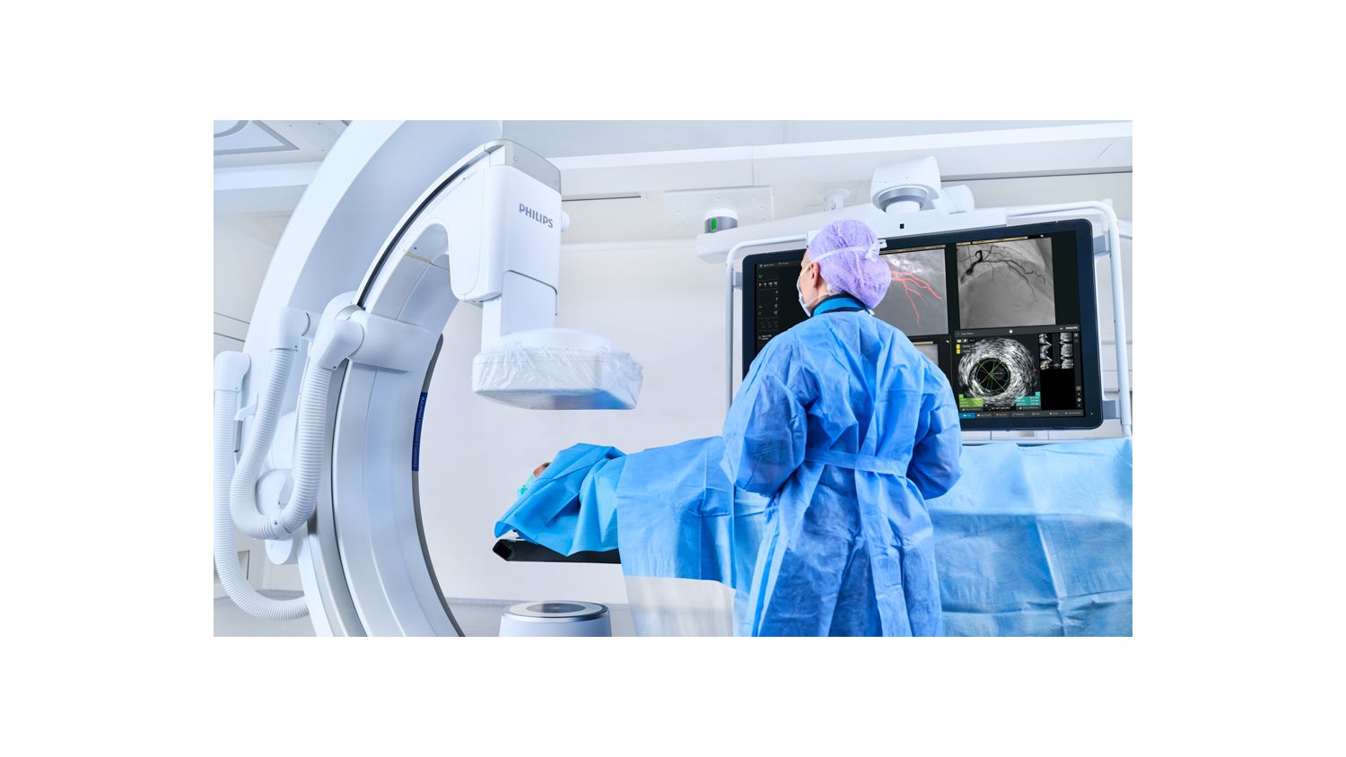 smart iq technology coronary imaging
