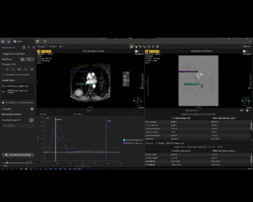 How intelligent automation can help every POC ultrasound user