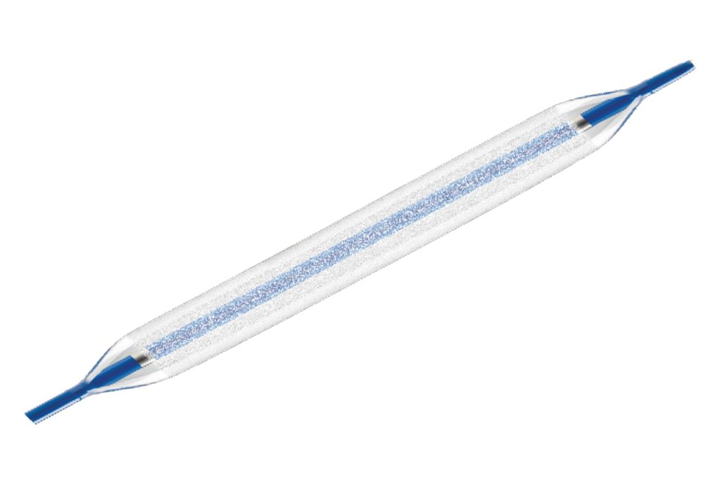 Low tip profile (0.039") and high pushability facilitate trackability and lesion crossing, even in challenging anatomies and through previously deployed stents.