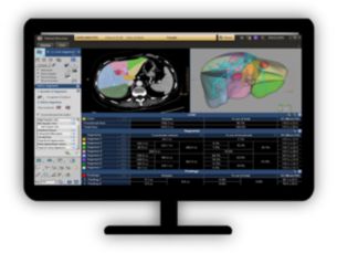 CT Liver Analysis​ Advanced Liver segmentation