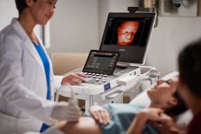 Compact Ultrasound System 5000 series for Ob/Gyn