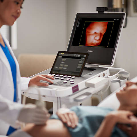 Compact Ultrasound System 5000 series for Ob/Gyn