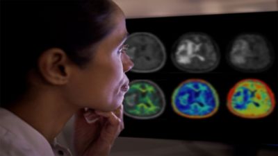 Clinician reviewing multimodal brain scans on Philips diagnostic imaging workstation