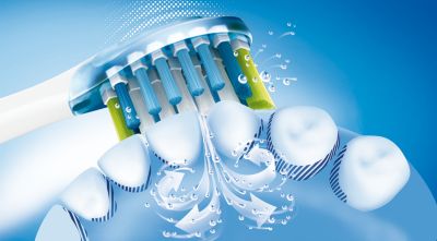 Philips Sonicare's advanced sonic technology