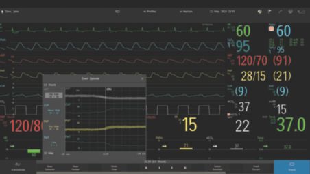 Gestione avanzata degli allarmi