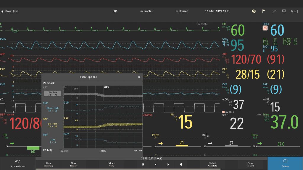 Be alert to relevant clinical changes