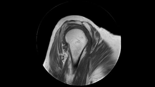 MultiVane XD - Sagittal T1w TSE