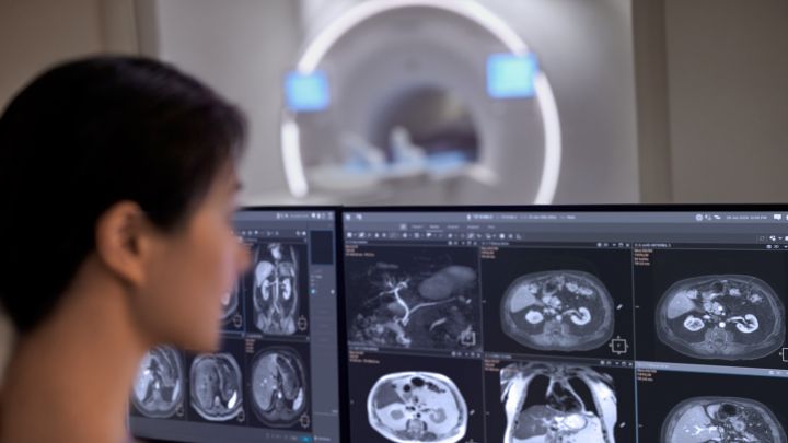 Investigador preparando a un paciente para un examen de rodilla en MR 7700