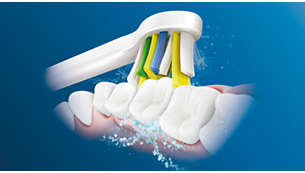 音波水流で歯間の歯垢を除去