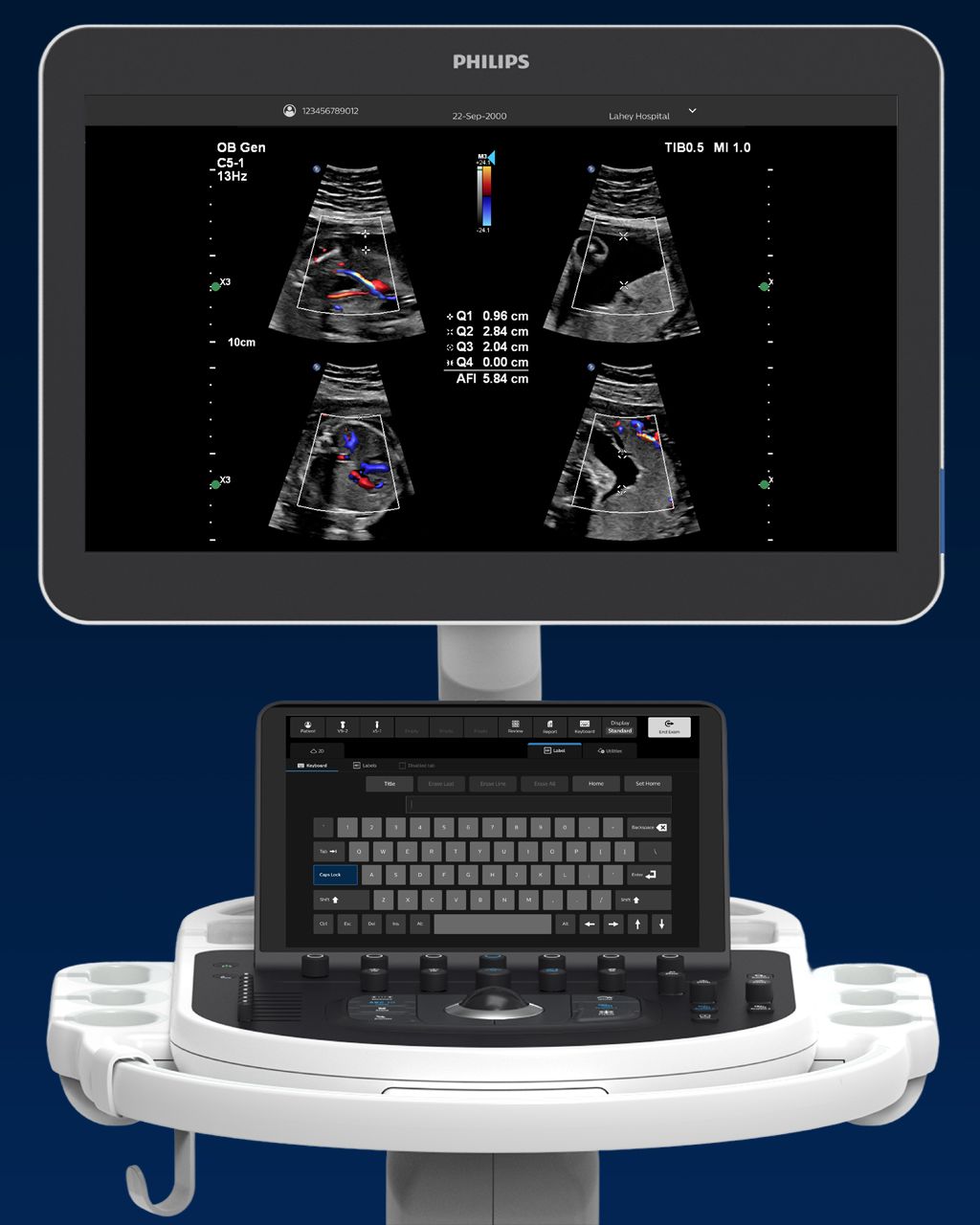 quadrant imaging in ultrasound