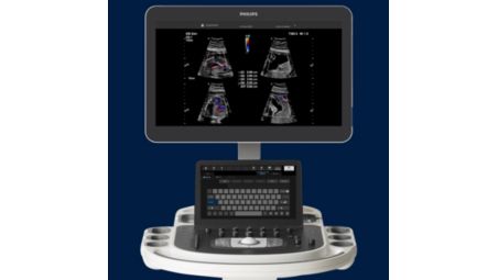 Fast, consistent AFI assessments 