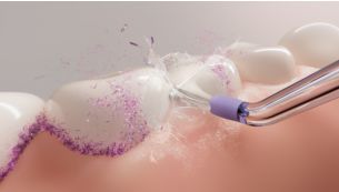 Up to 150% more effective vs floss in improving gum health**