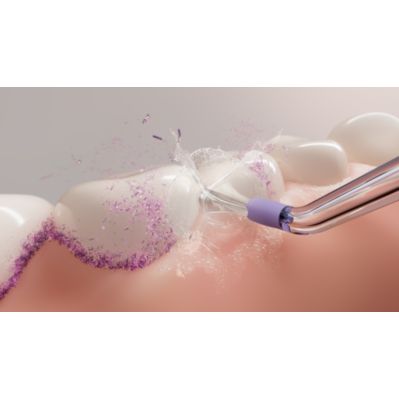 PID Refresh Cordless Feature Image (PPL) F3 CGI mouth