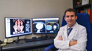 Eliseo Vañó Galván, MD, shows the Philips fully integrated diagnostic workspace for radiology.