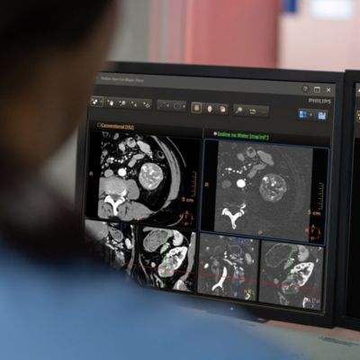 Philips VeridaシステムのスペクトラルCT画像を表示する臨床用ワークステーション