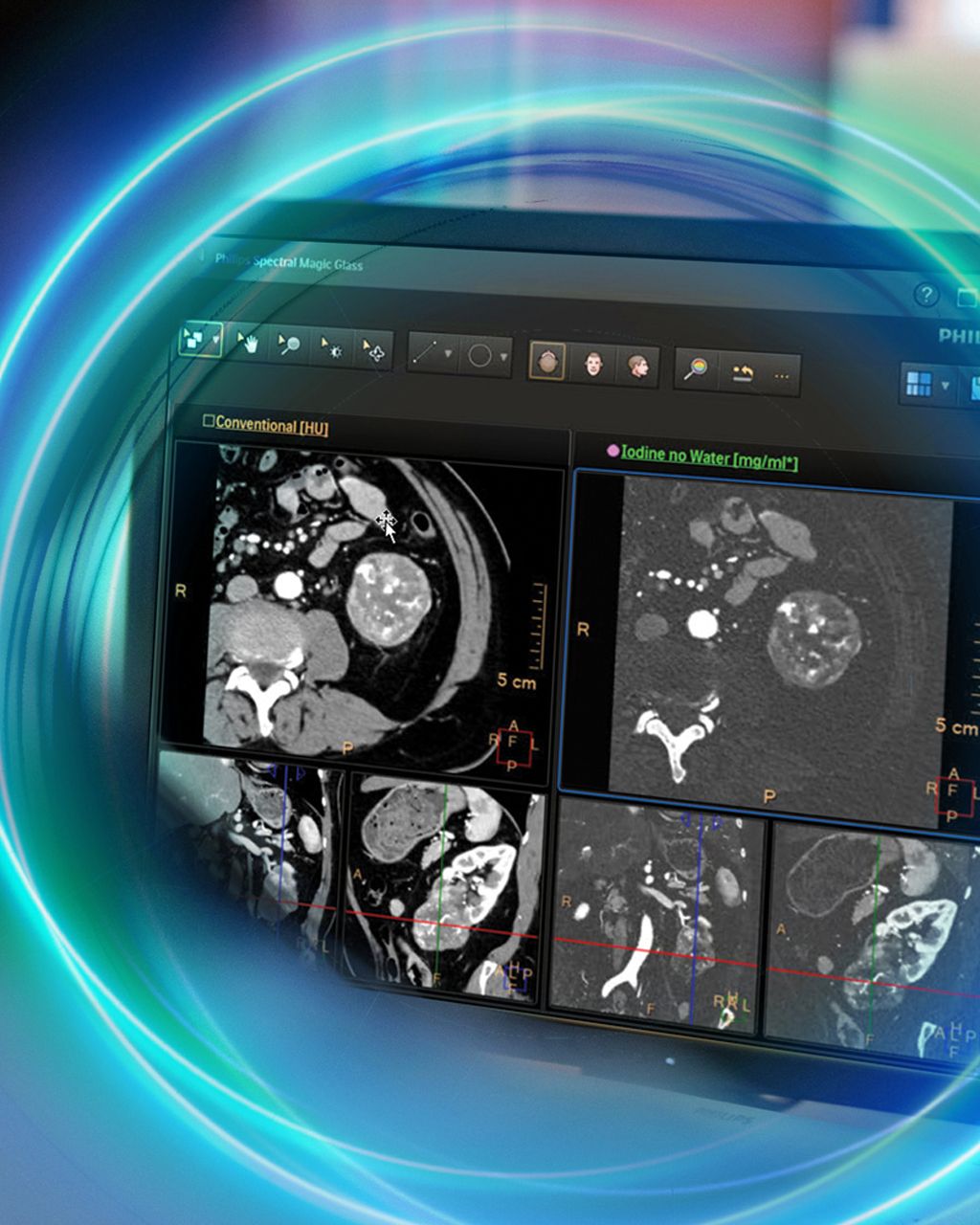 CT clinical images on monitor