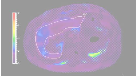 MR Elastography Клиническое приложение для МР-исследований
