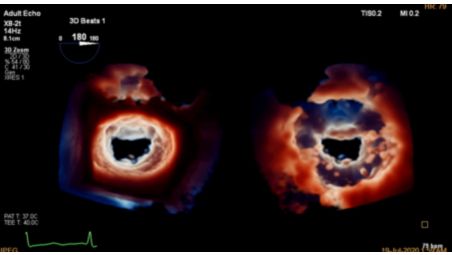 Photorealistic echo imaging with adjustable light source