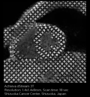 Myocardial tagging