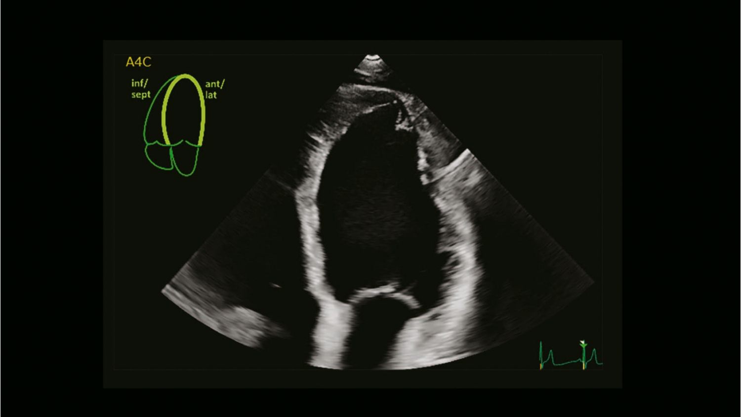 AutoStrain clinical image showing Auto View Recognition