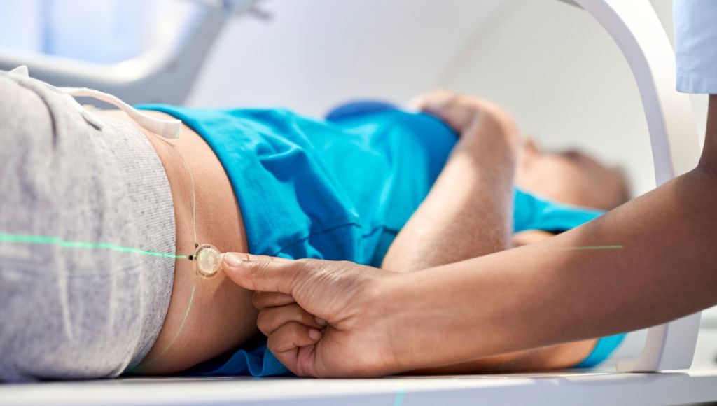 Put Philips MR-only radiotherapy to work today