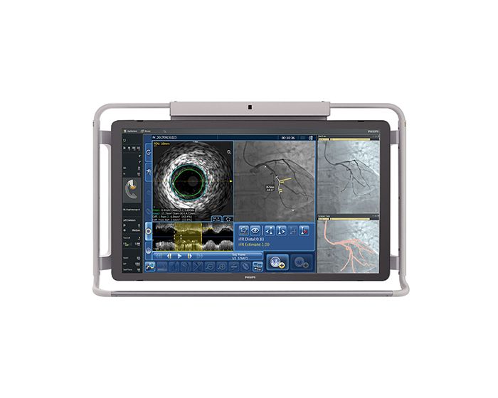 Image guided therapy full picture