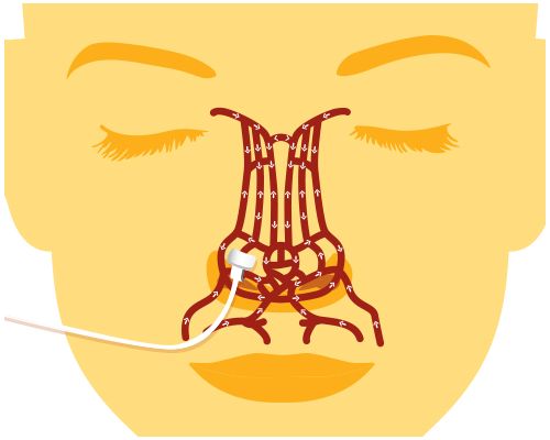 Nasal Alar SpO₂ Sensor flow