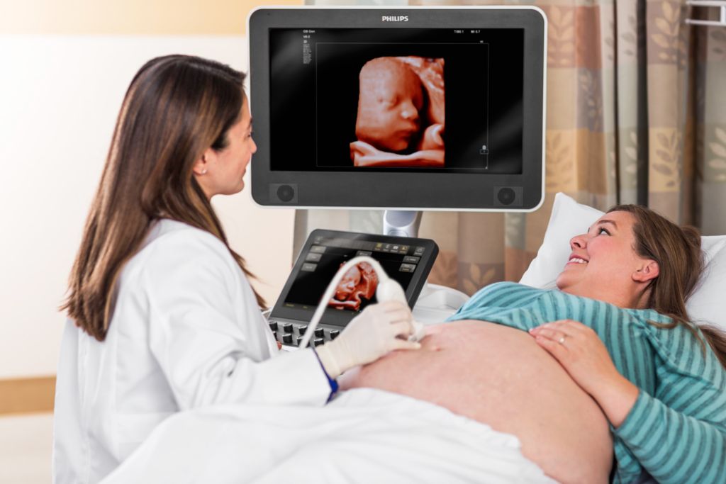 Ultrasound OB TDP Scan with eL18-4 Transducer