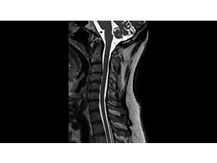 3D SpineVIEW MR Clinical application