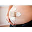 Avalon beltless fetal monitoring solution  Cableless fetal and maternal pod with adhesive patch