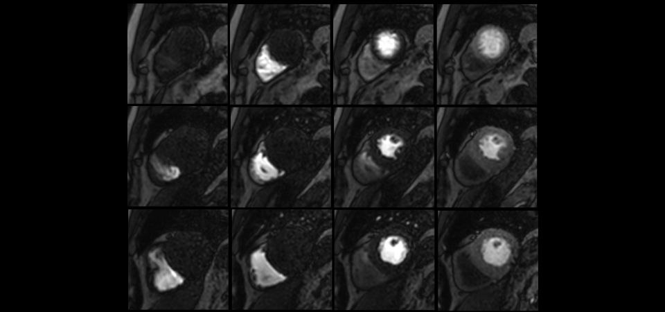 Multi-slice dynamic study