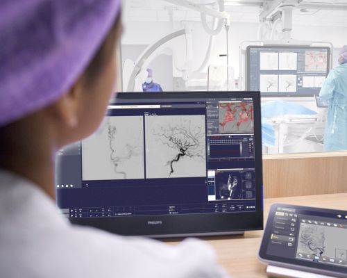 Full tableside control saves time