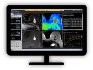 MR T1 Perfusion​ Support in assessing lesions by reviewing blood supply characteristics