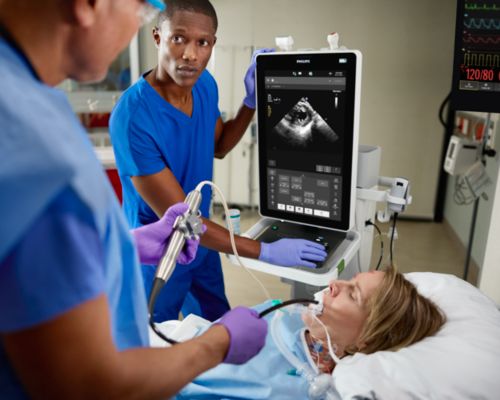 How intelligent automation can help every POC ultrasound user