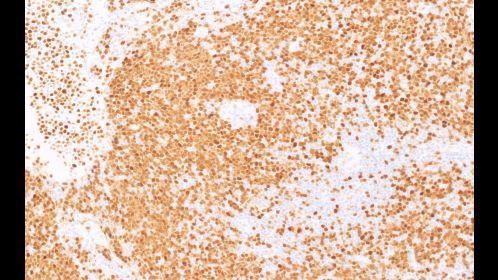 Clinical image digital pathology