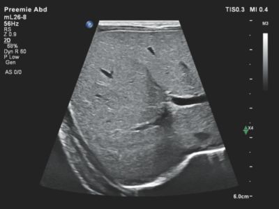 Ultrasound web NextGen Autoscan