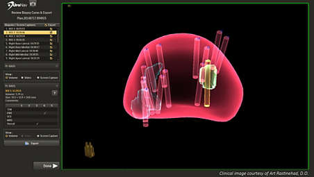 Revisión 3D integral de la biopsia siguiendo el procedimiento