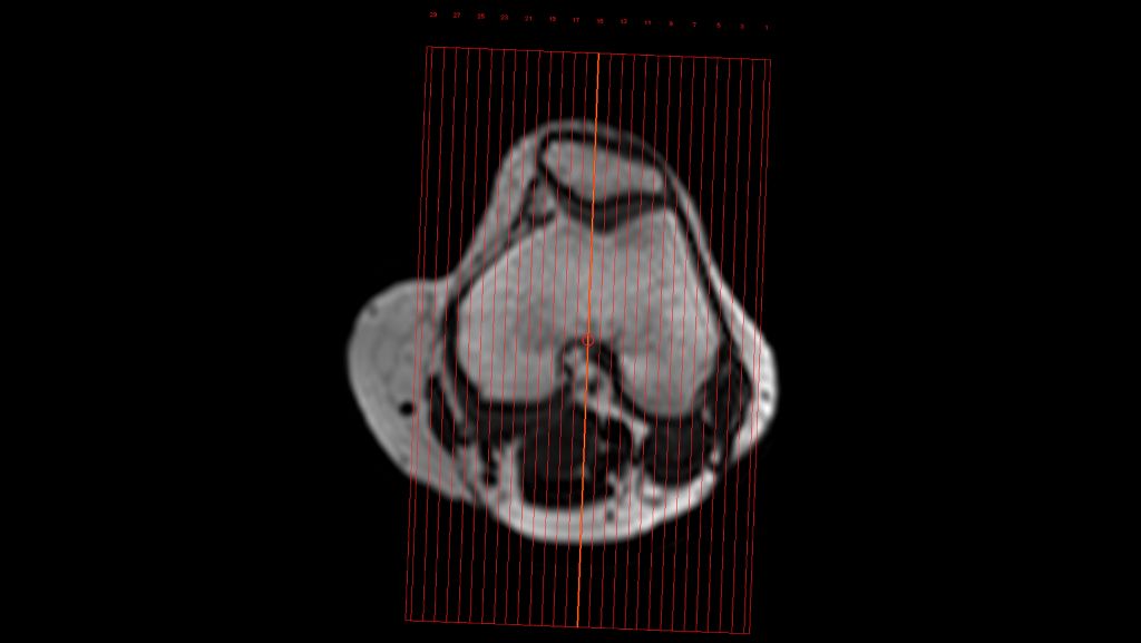 SmartExam Knee