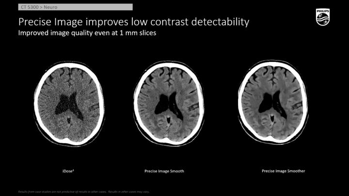 大阪府知事、オランダ大使館、フィリップス合同でのリボンカット