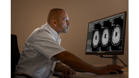 Advanced brain imaging enabling fast, confident diagnosis1,2,3