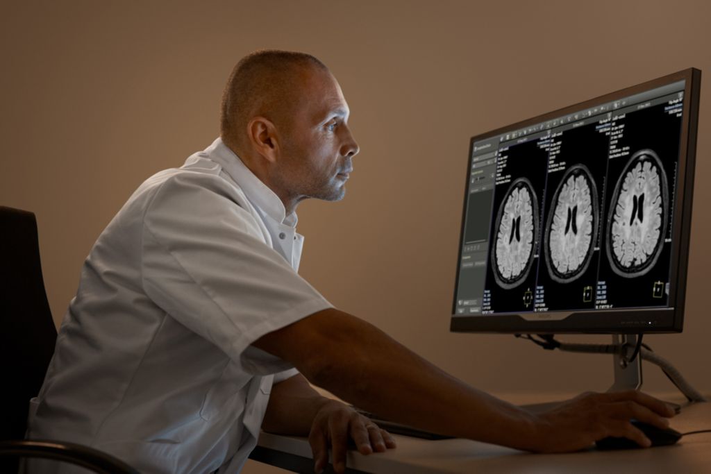 Feature name	Advanced brain imaging enabling fast, confident diagnosis1,2,3