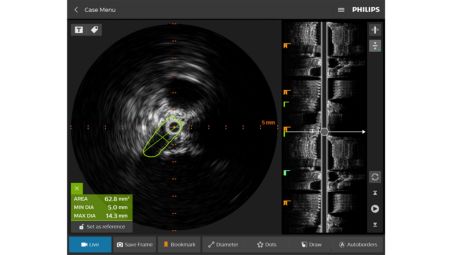 Designed to facilitate training and quickly onboard new users and maintain staff proficiency featuring a venous compression case.