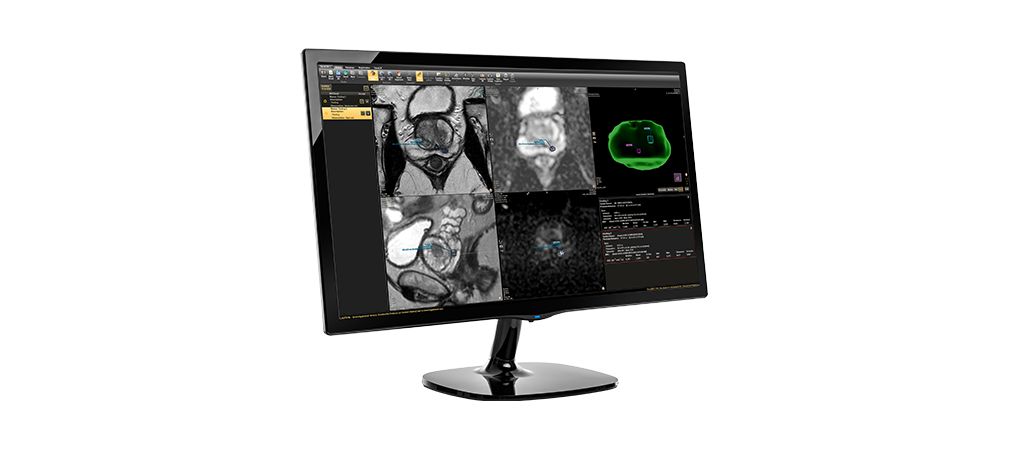 DynaCAD Prostate AI-Assisted Prostate MRI analysis